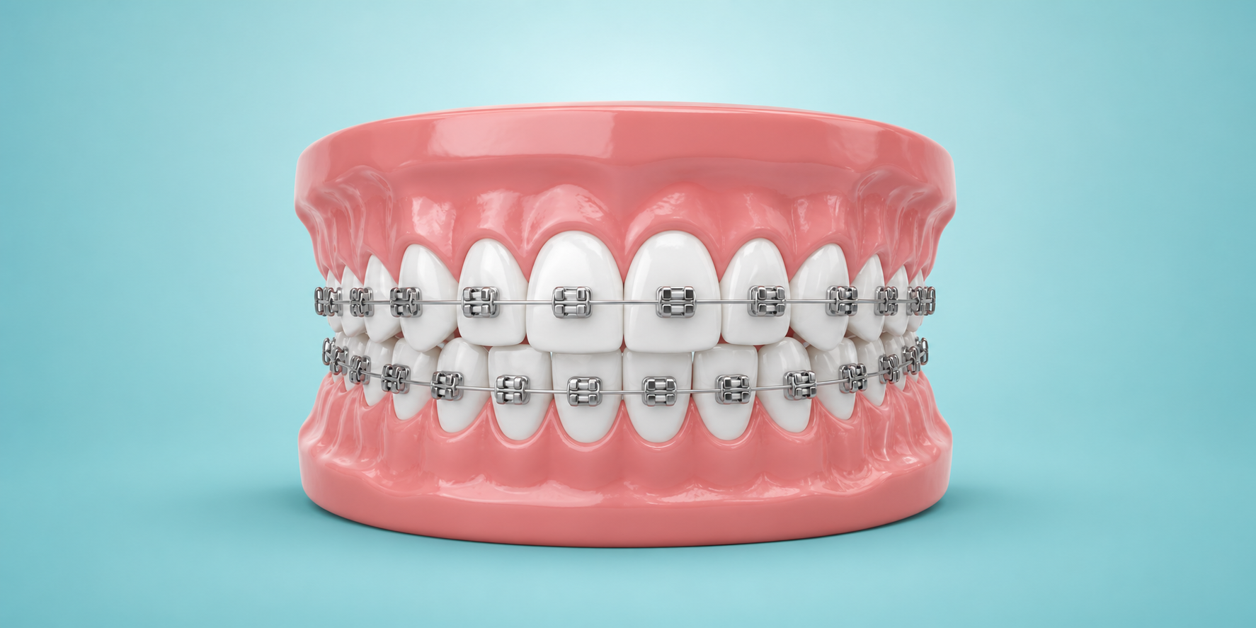 Braces in Dubai